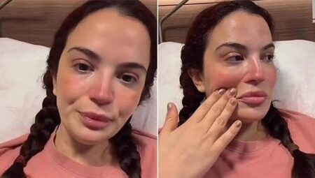 Aslı Bekiroğlu Ameliyat Sürecini Açıkladı: 9’uncu Operasyona Hazırlanıyor