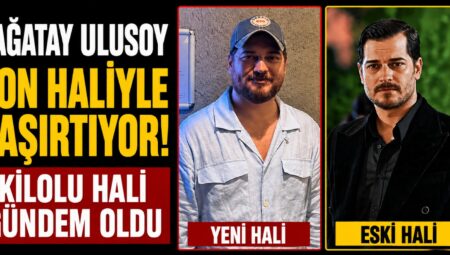 Çağatay Ulusoy Son Haliyle Gündem Oldu