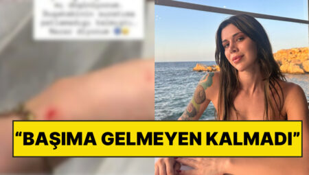 Ateşi 40’ı Bulmuştu: Survivor Şampiyonu Nefise Karatay Bu Kez Evinde Yaşadığı Kazayla Sevenlerini Korkuttu!
