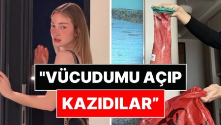 Danla Bilic Dokuzuncu Ameliyatın Perde Arkasını Anlattı: “Bu Son Kurşunumuzdu!”