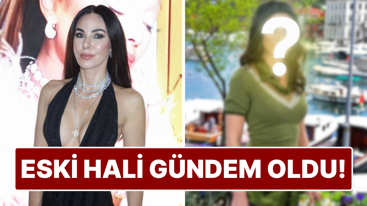 Güzelliğiyle Konuşulan Defne Samyeli, Kendini En Çirkin Hissettiği Dönemi Açıkladı!