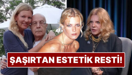Mazhar Alanson’dan Eşi Biricik Suden’e Estetik Uyarısı: “Boşarım” Dediği Estetik İşlemini Anlattı