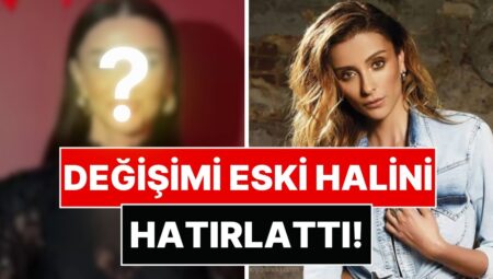 Özge Ulusoy’un Yüzünün Son Hali Gündem Oldu: Değişimi Eski Halini Hatırlattı!