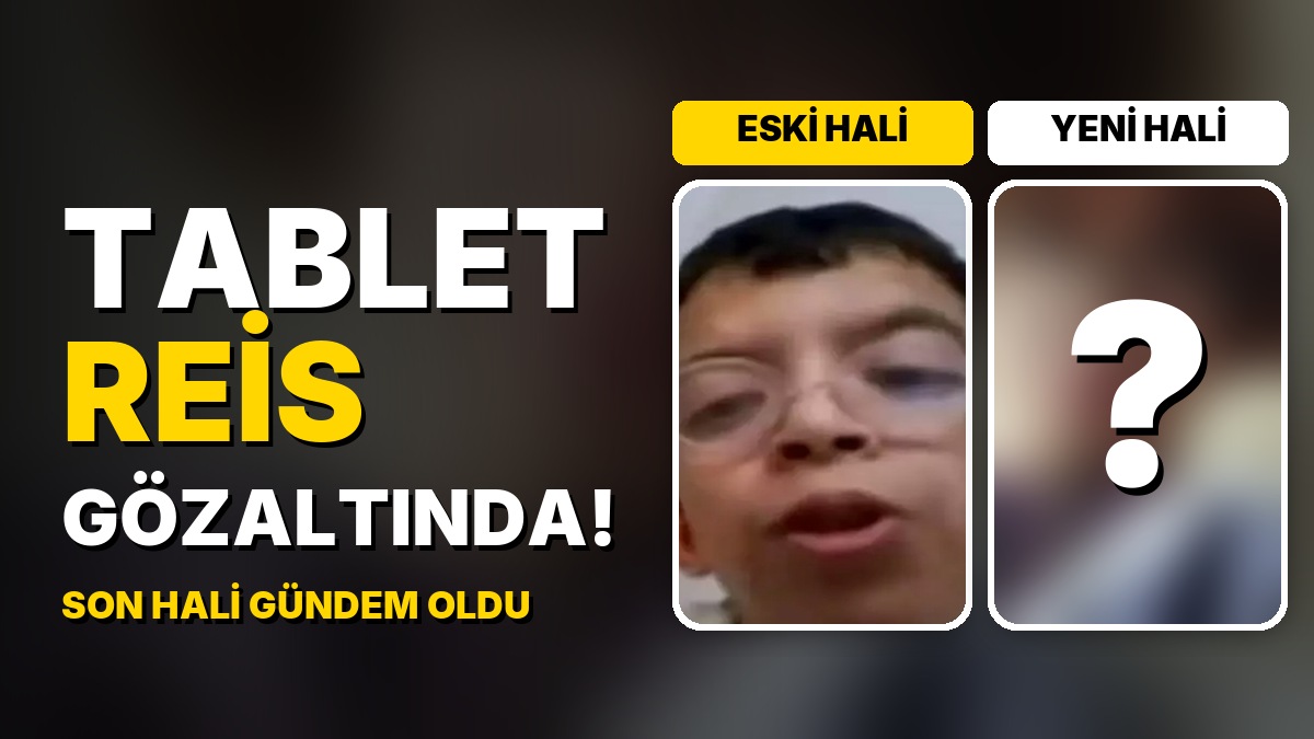 Tablet Reis Onurcan Güzel Gözaltına Alındı: Estetiklerle Değişen Yüzünün Son Hali Gündem Oldu!
