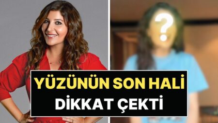 Verdiği 20 Kiloyla Gündem Olmuştu: Şebnem Bozoklu’nun Yüzündeki Değişim Dikkat Çekti!
